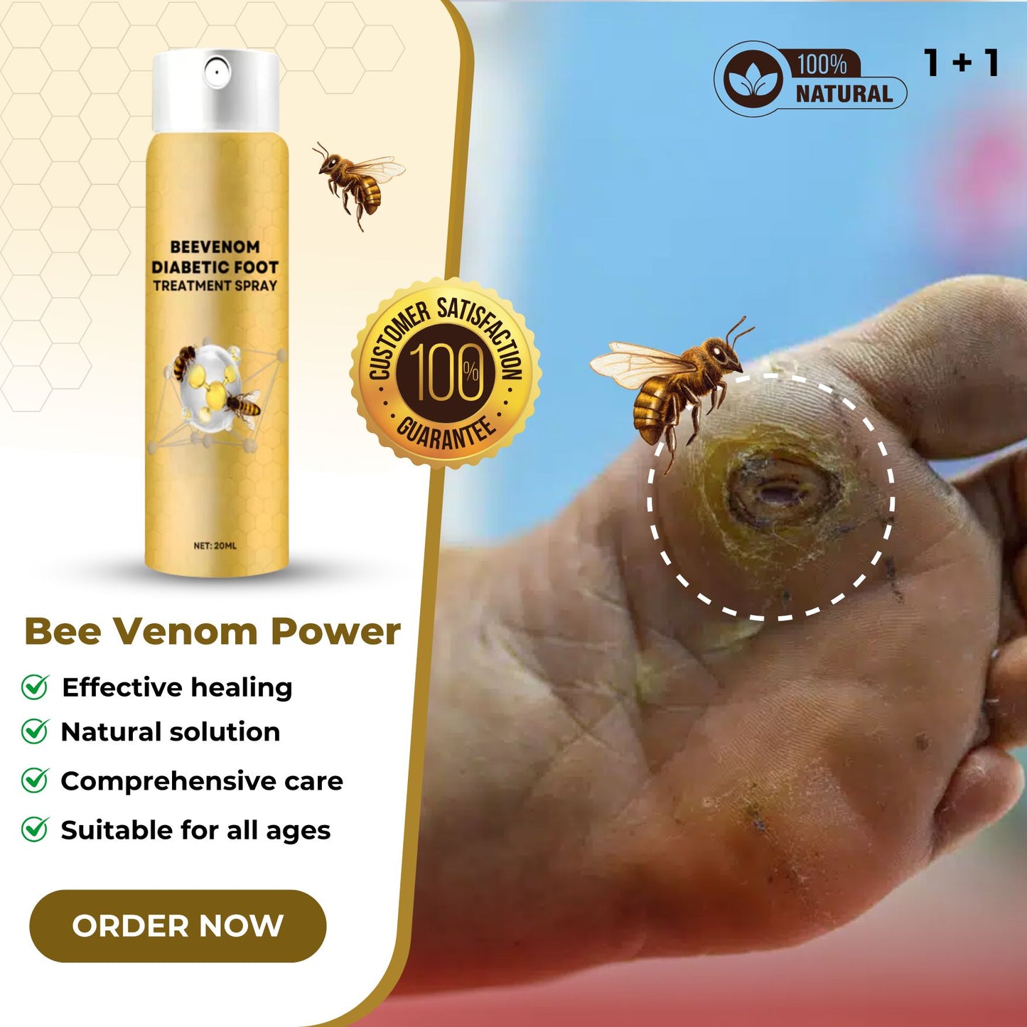 BeeRelief™ - BeeVenom Diabetic Foot Treatment Spray (Buy 1 Get 1 Free🔥🔥)