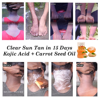 GlowPure™ - Kojie-San Skin Lightening Soap ✨🧼