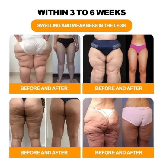 Bee Venom & 30-Herb Detox Foot Soak Beads for Body Sculpting (Buy 1 Get 1 Free🔥🔥)