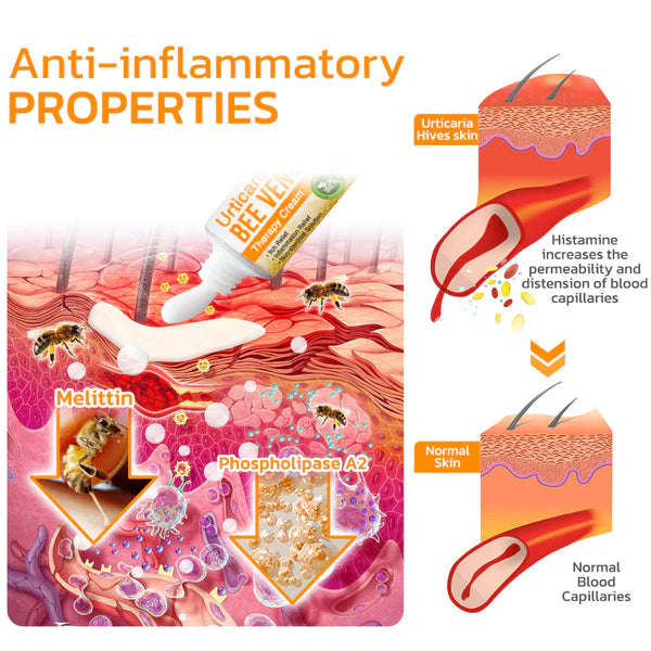 Urticaria Relief™ Bee Venom Therapy Cream – Soothe Itchy Skin & Boost Healing 🐝✨