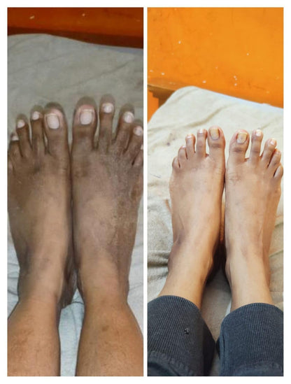 GlowPure™ - Kojie-San Skin Lightening Soap ✨🧼