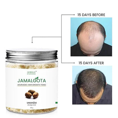 Jamalgota™ - Ayurvedic Hair Growth Powder 🌱✨ (Buy 1 Get 1 Free🔥🔥)