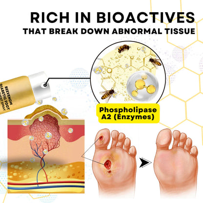 BeeRelief™ - BeeVenom Diabetic Foot Treatment Spray (Buy 1 Get 1 Free🔥🔥)