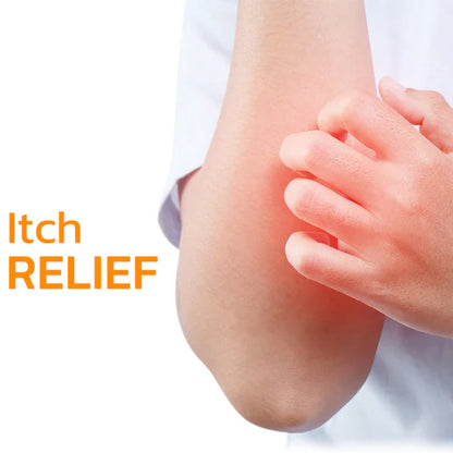 Urticaria Relief™ Bee Venom Therapy Cream – Soothe Itchy Skin & Boost Healing 🐝✨