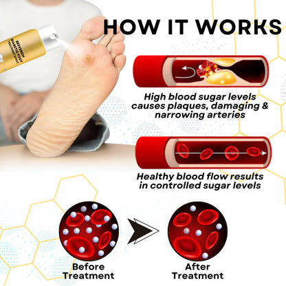 BeeRelief™ - BeeVenom Diabetic Foot Treatment Spray (Buy 1 Get 1 Free🔥🔥)