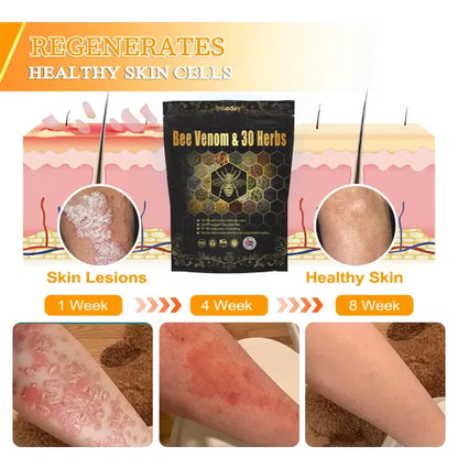 Bee Venom & 30-Herb Detox Foot Soak Beads for Body Sculpting (Buy 1 Get 1 Free🔥🔥)